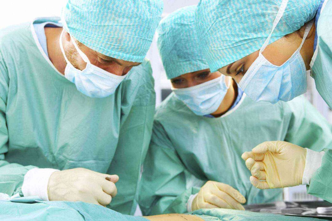 Penis enlargement surgery and photo price 3