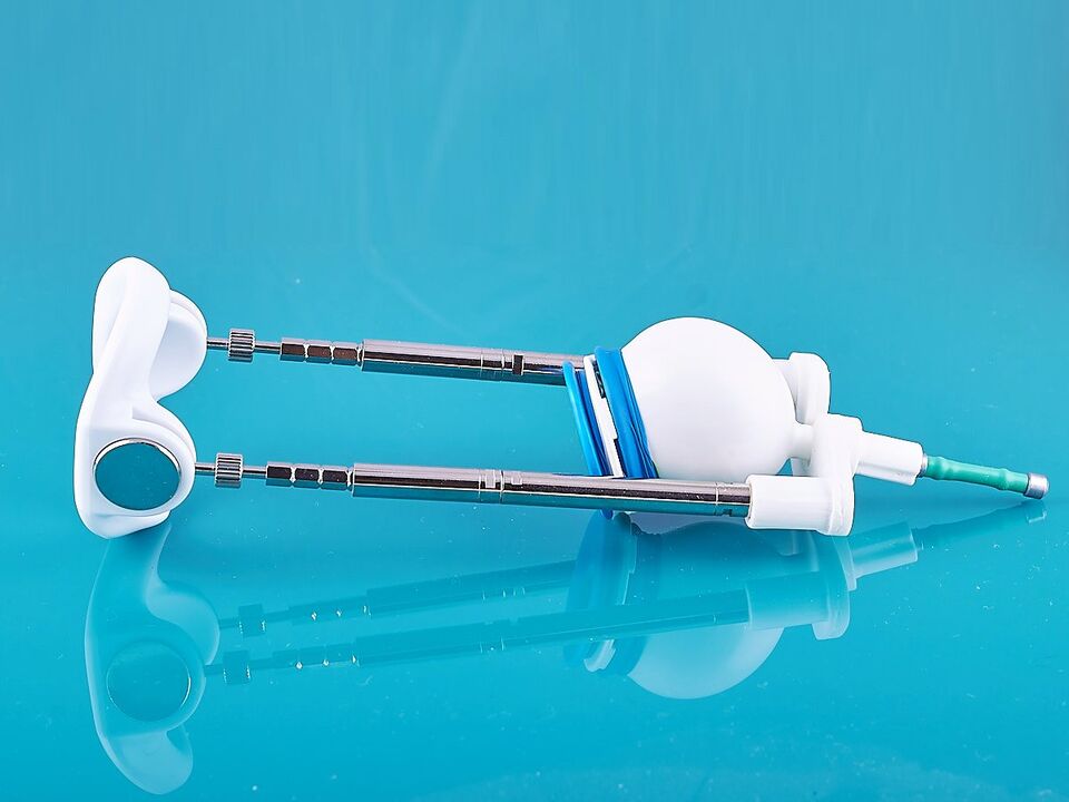 Extenders will help improve ligamentotomy results